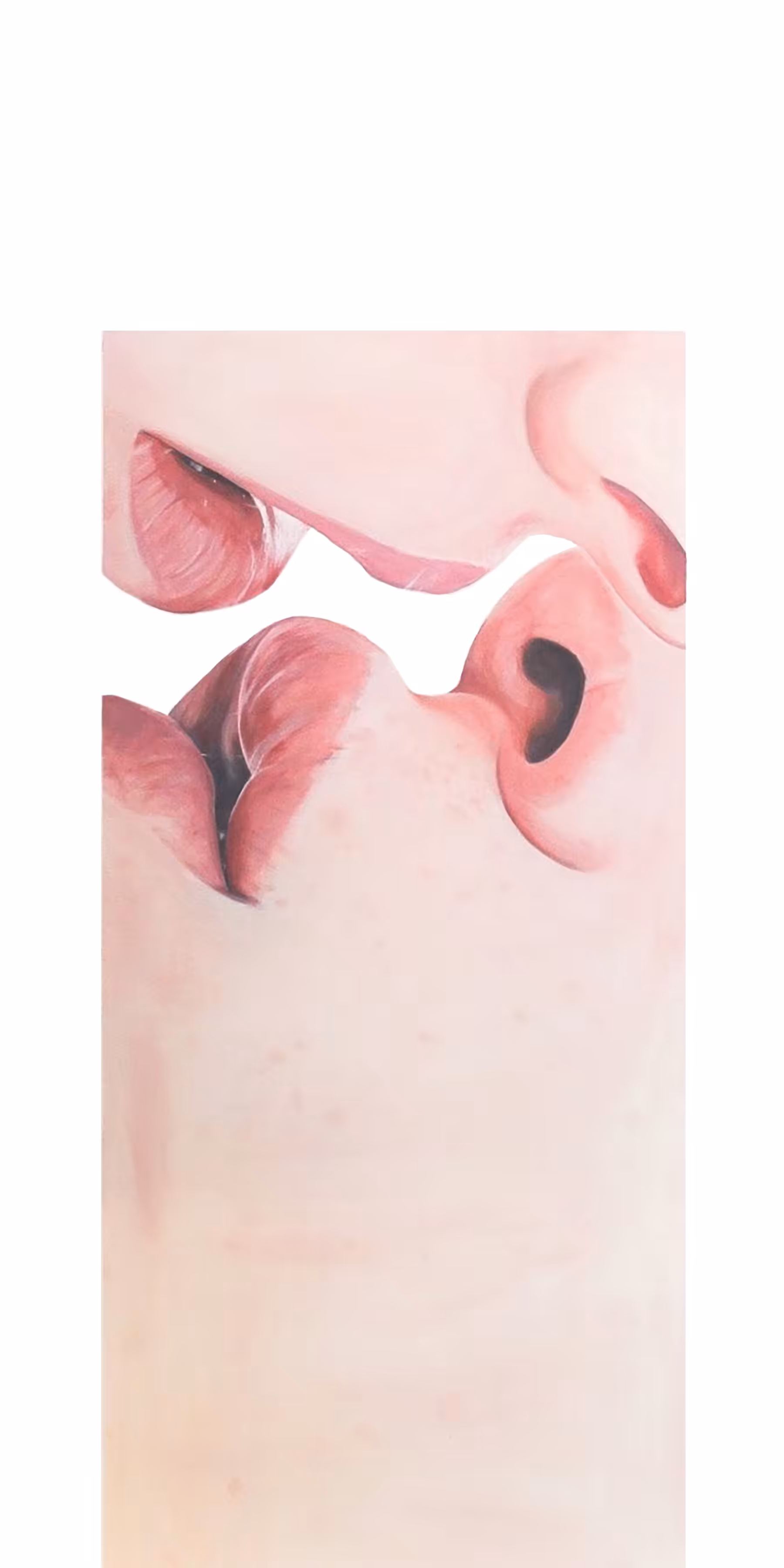 Kiss