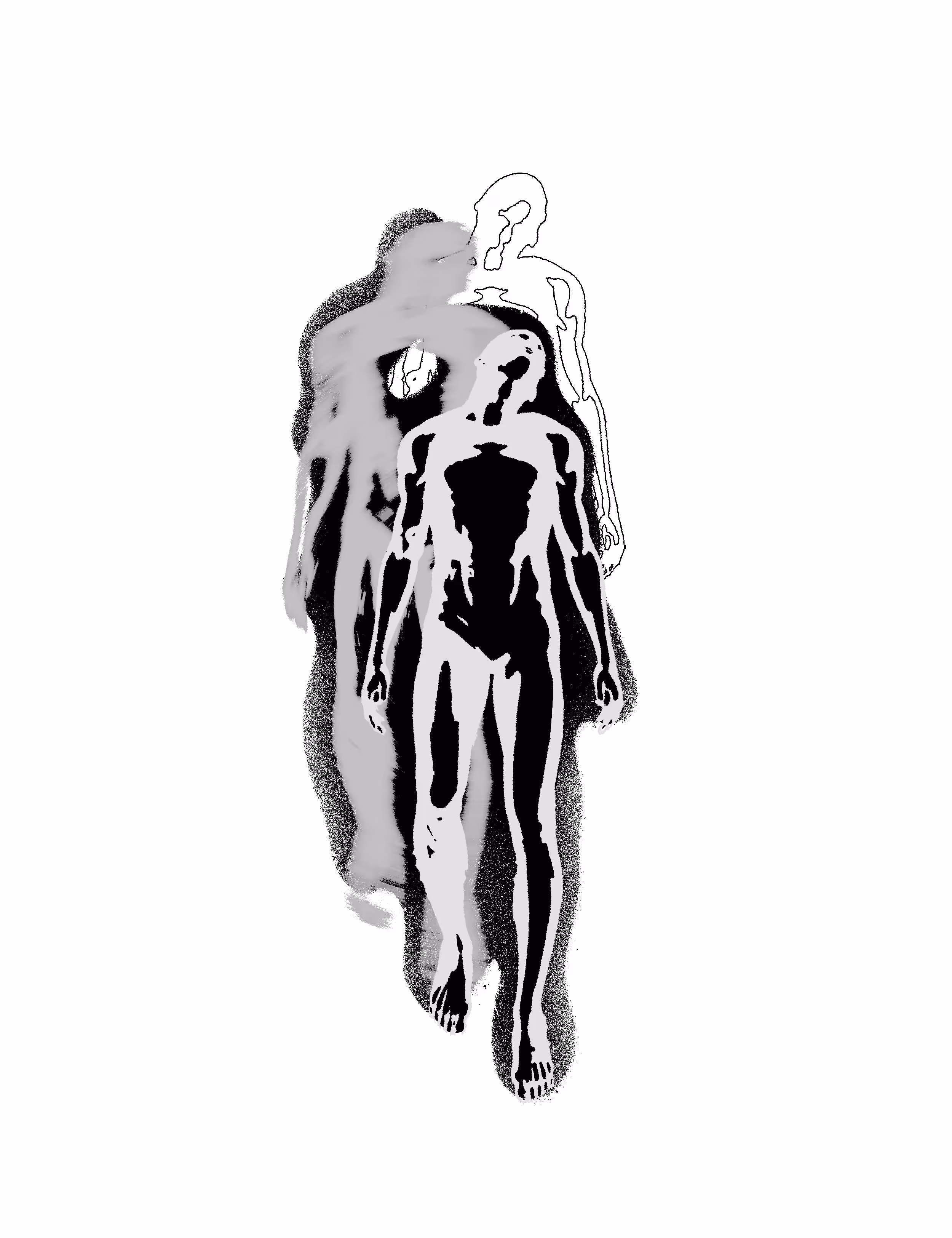 Altered vision