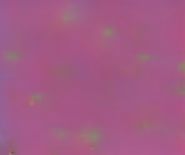 Quantum superposition