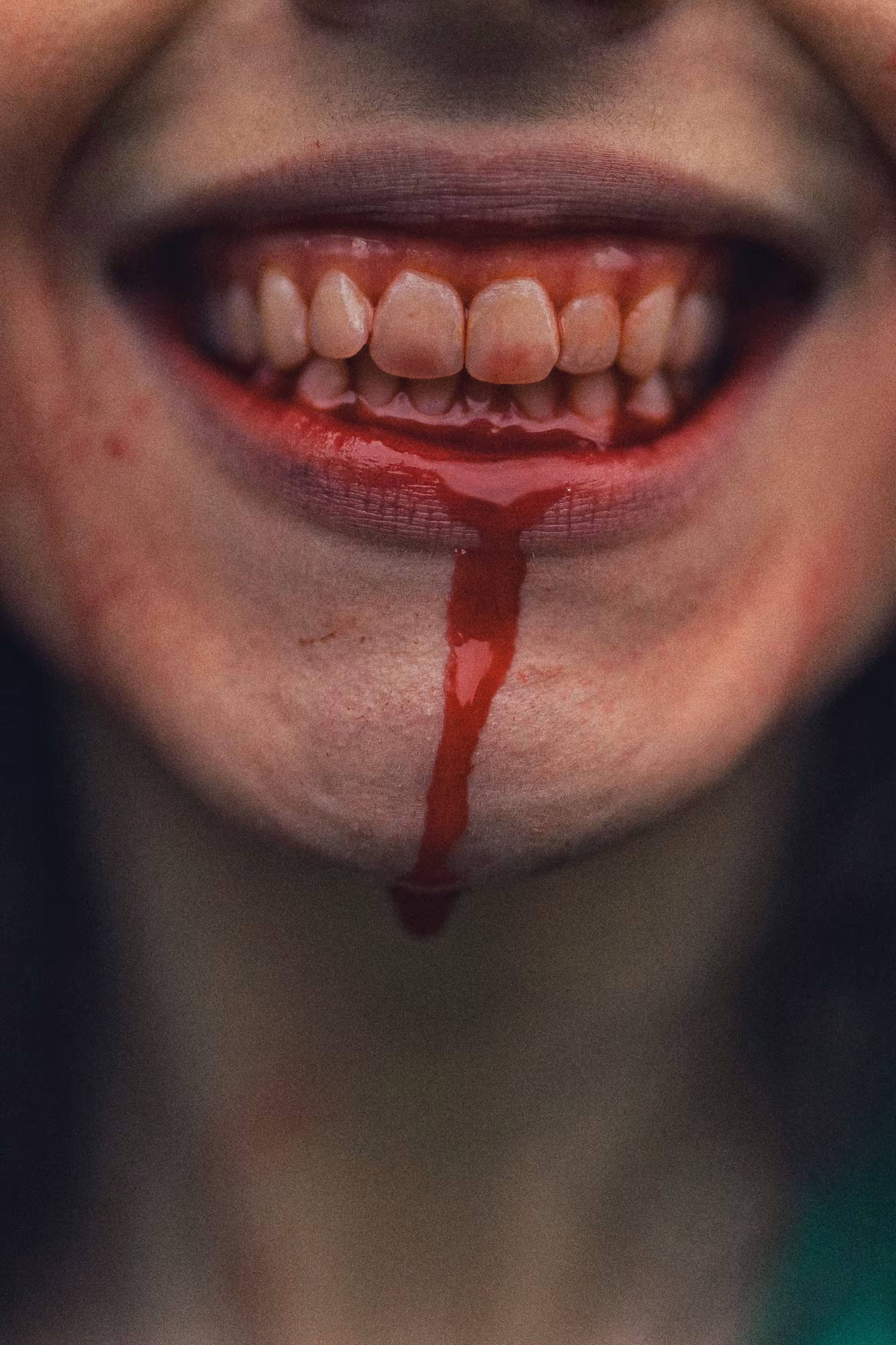 Bloody mouth 