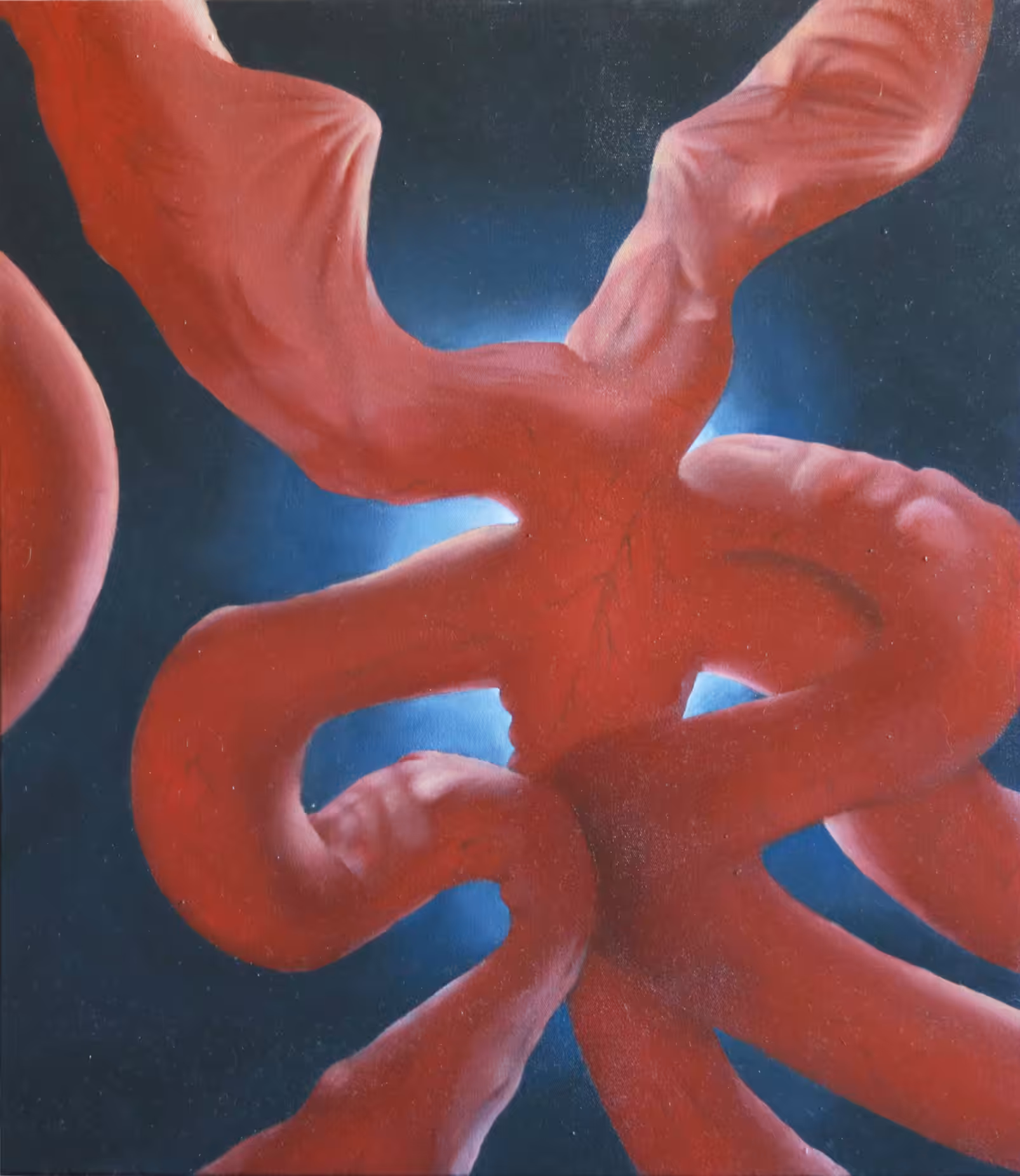An Abstract Body tree
