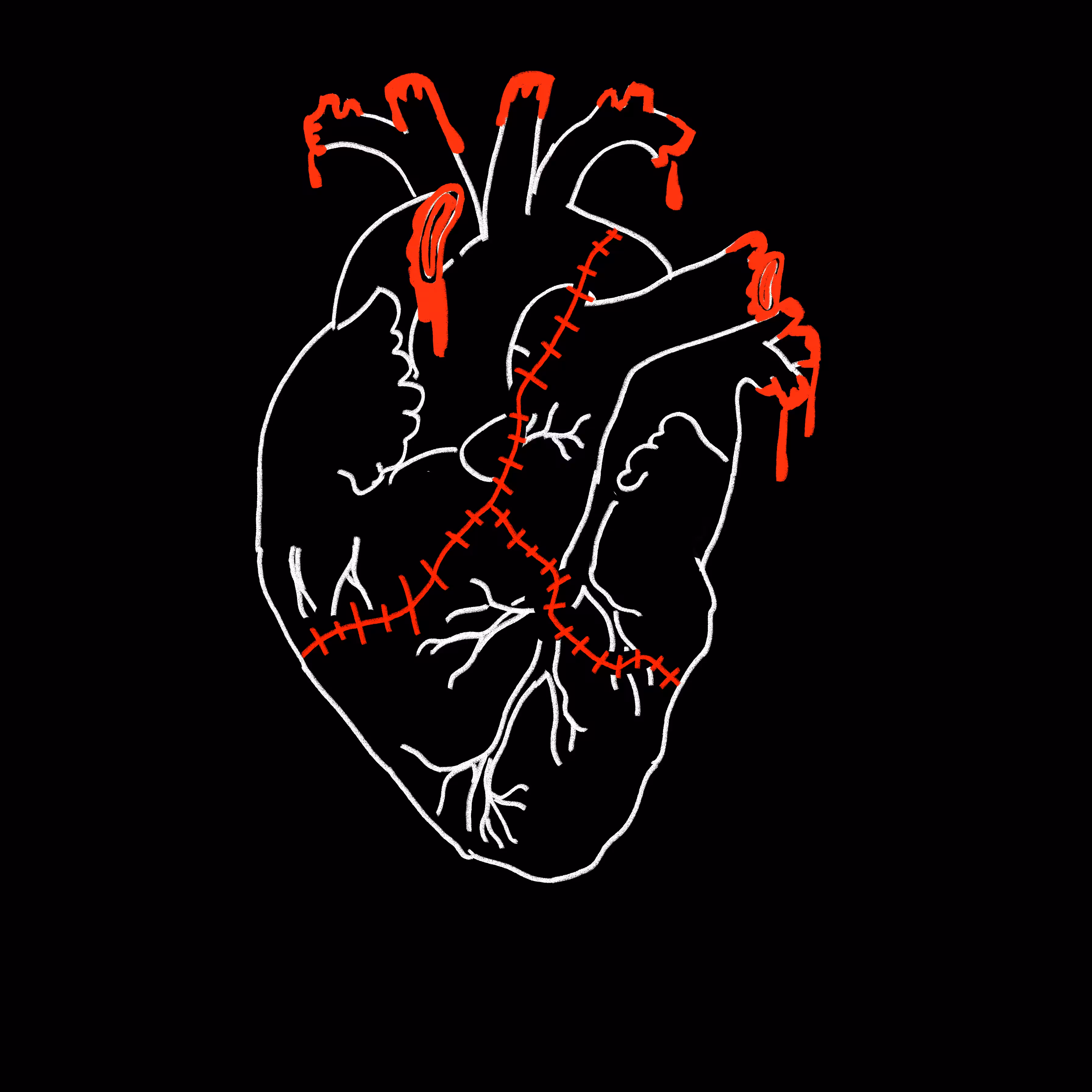Stitched Heart