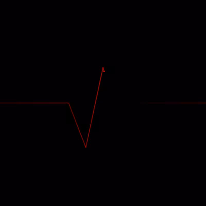 Beat of heart #4