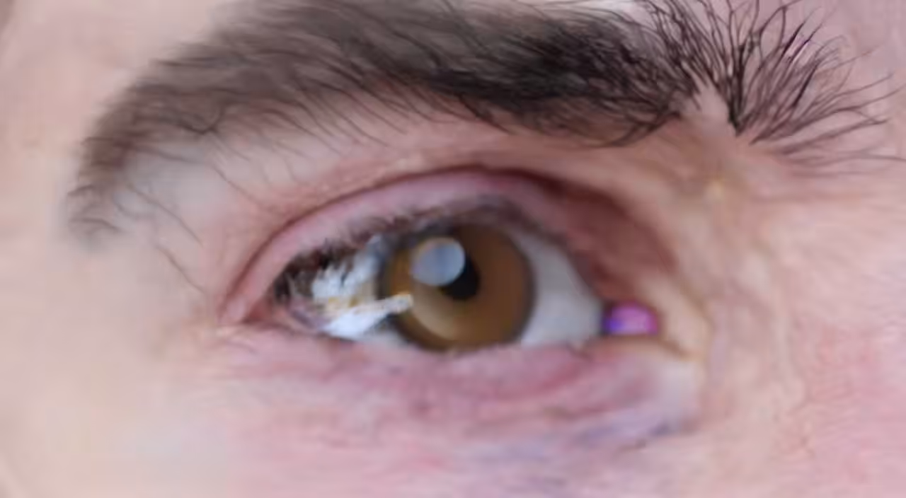 Milo Poelman - Eye 5 - Seeing