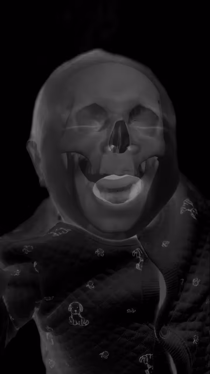 Crying Baby Xray