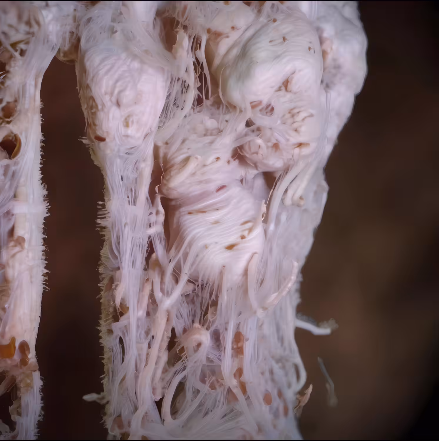 -soft tissue2