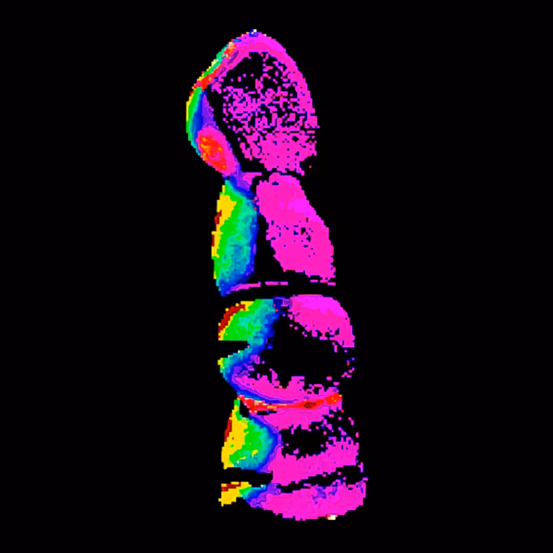 006