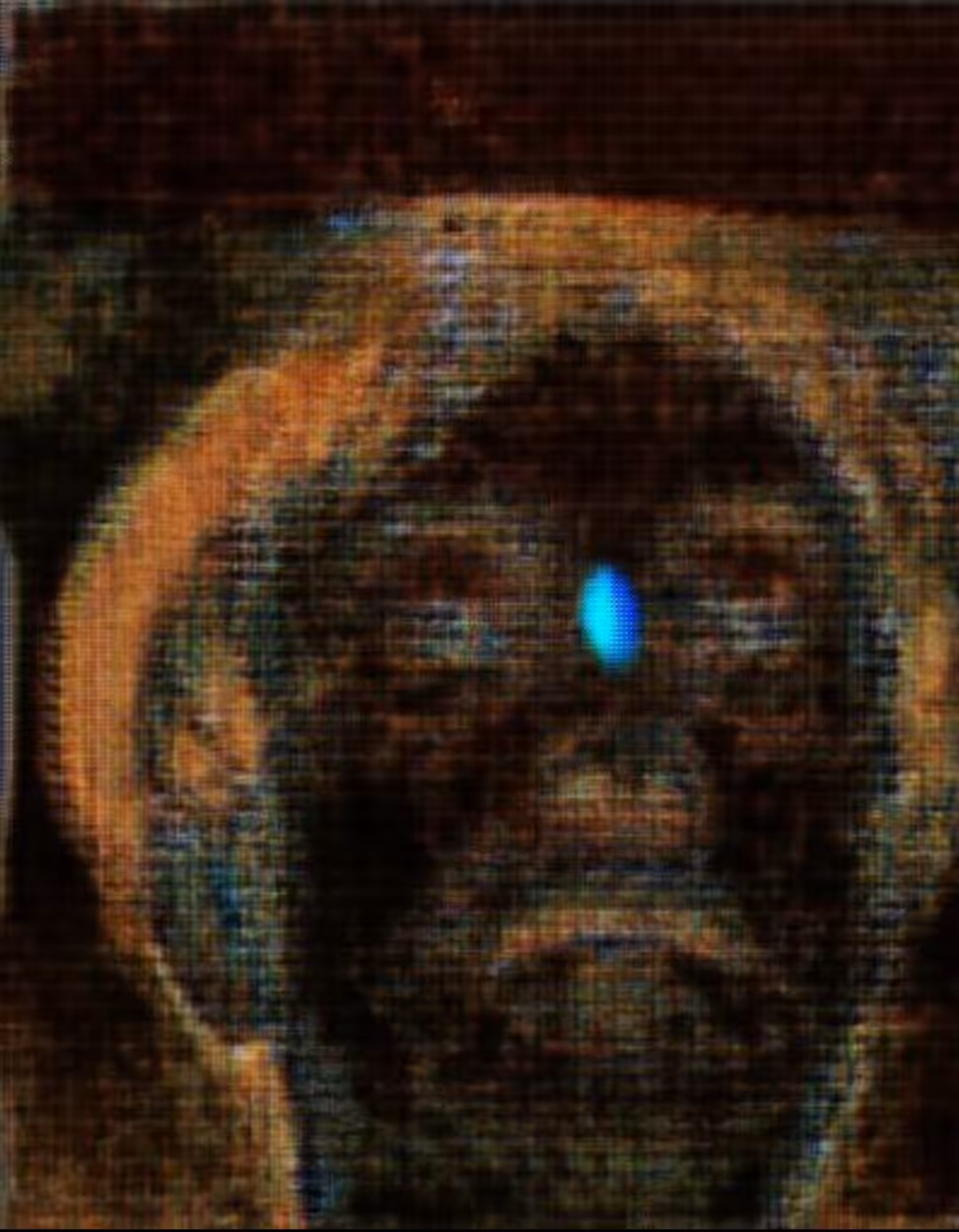 Satoshi's Glitch