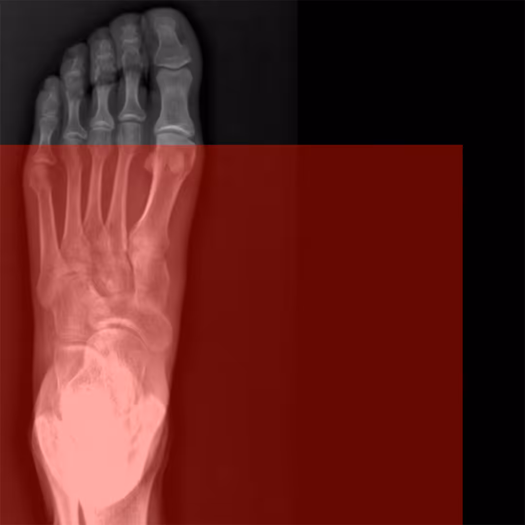 X-Ray_02
