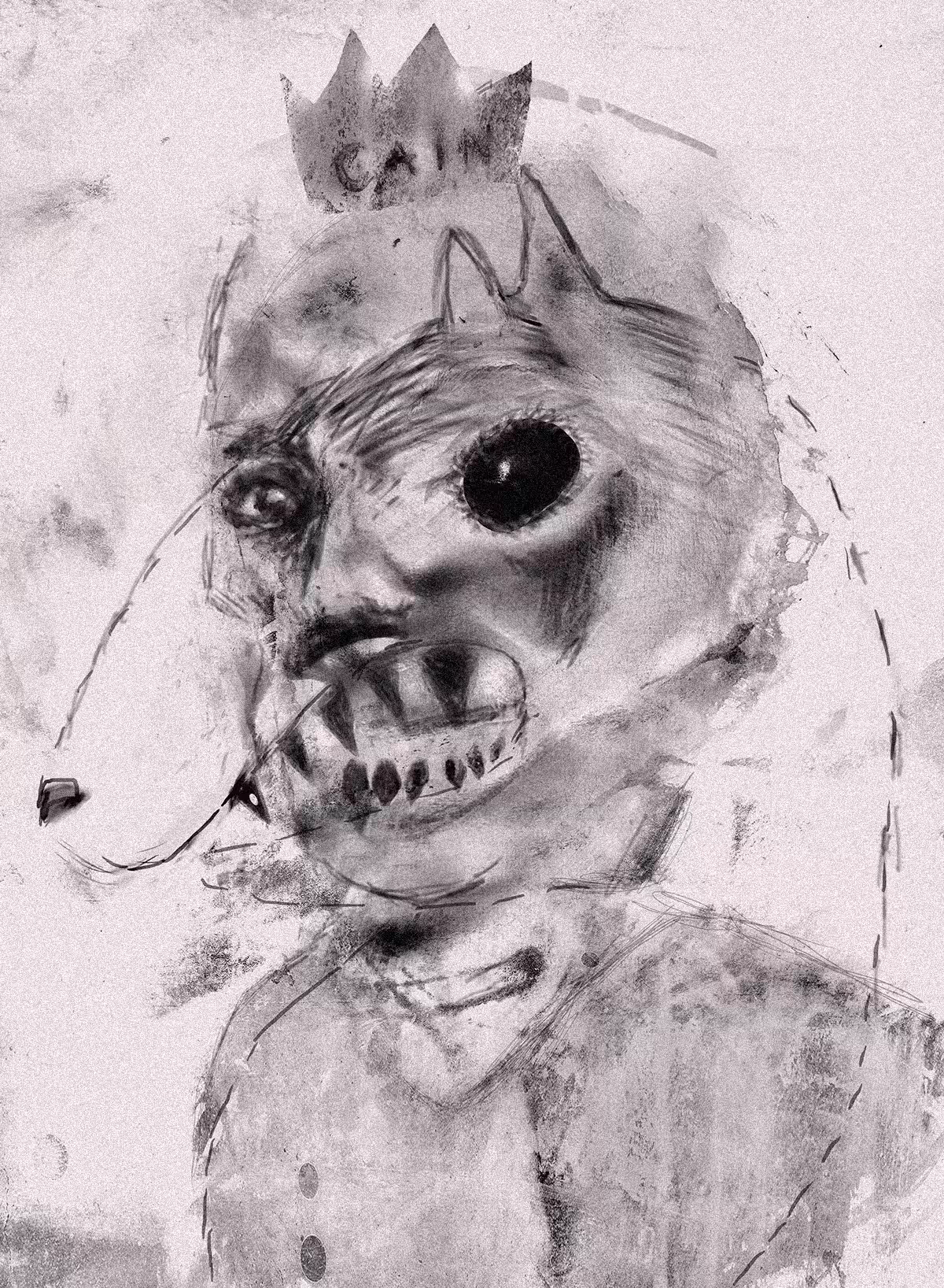Aboriginal Anemia 4