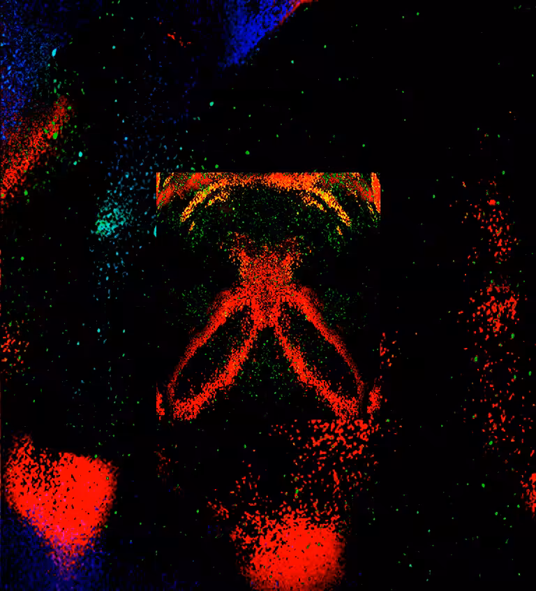 anima I