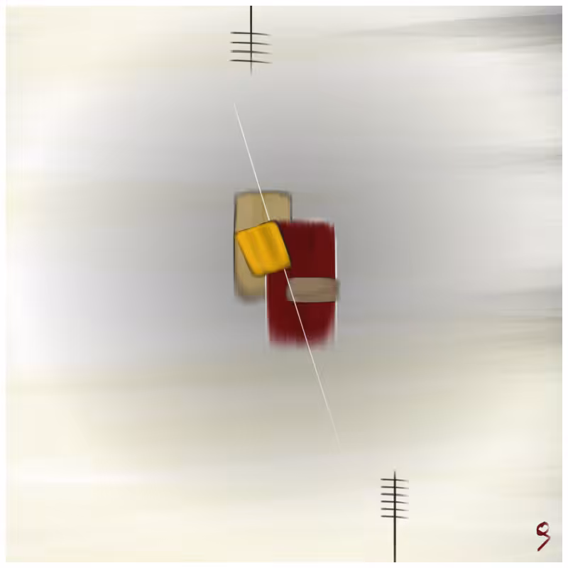 Goldsquare alpha #1