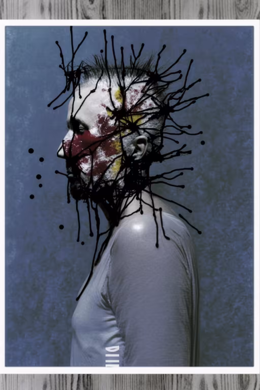 Headache