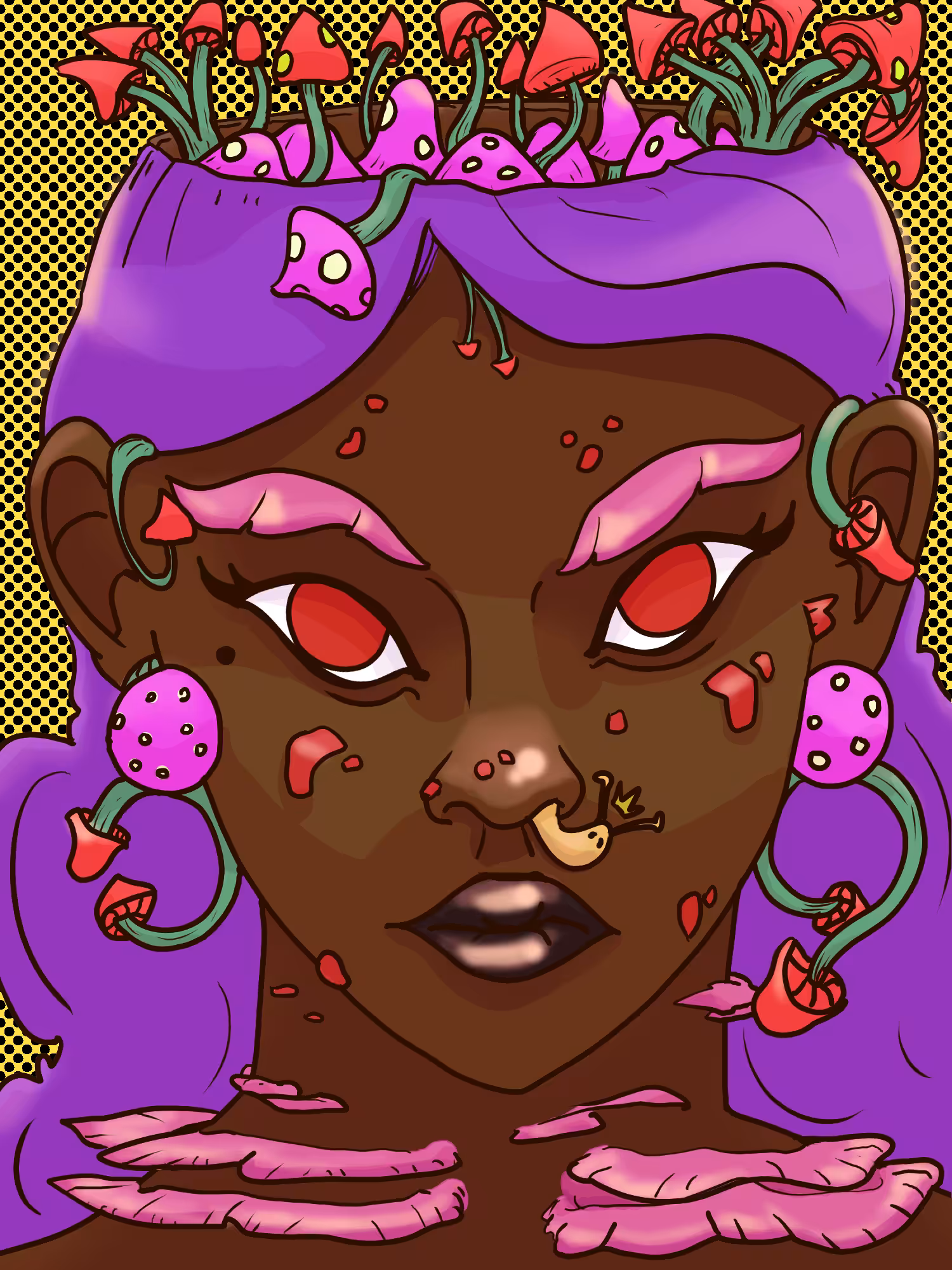 Infection 11