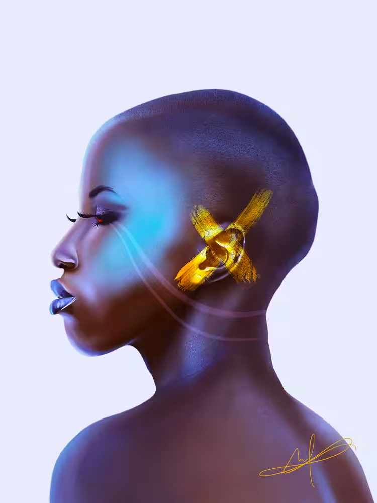 X