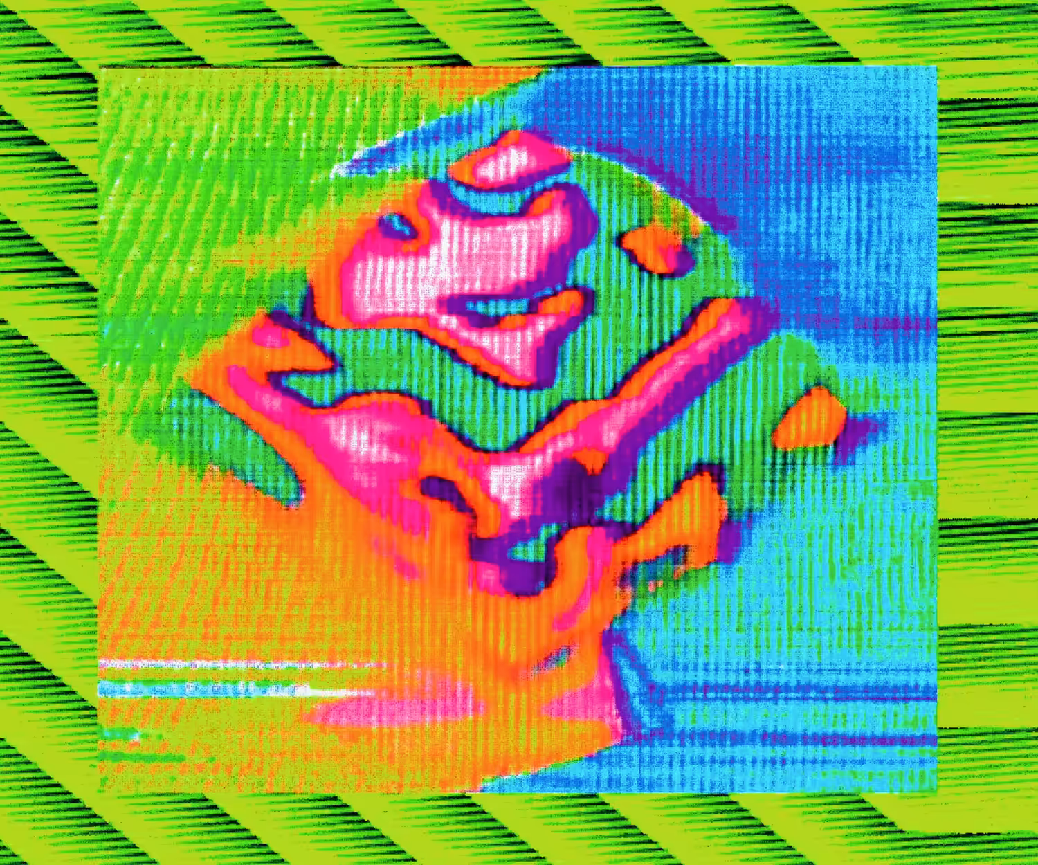 fever dream II