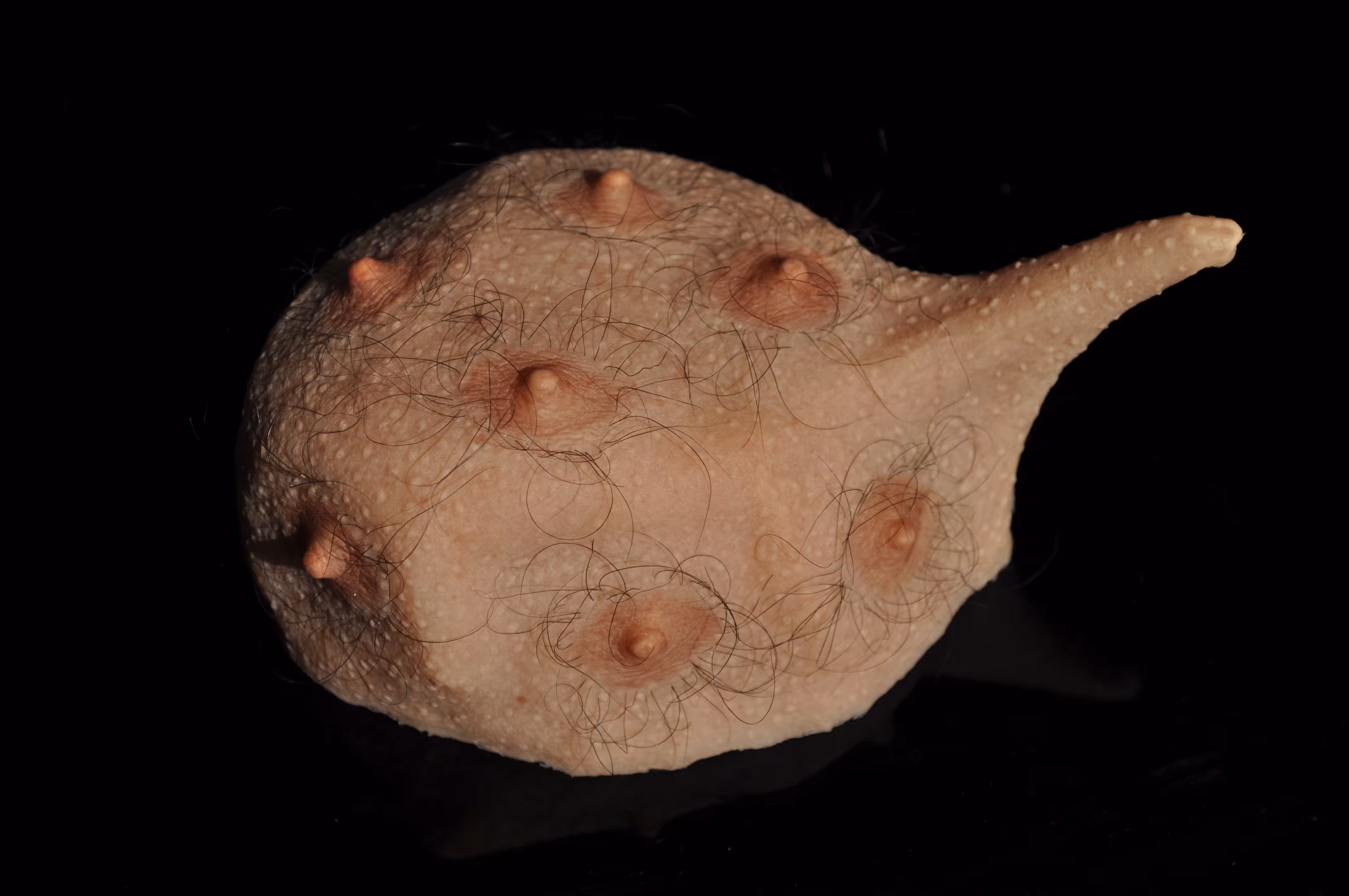 Areolas 