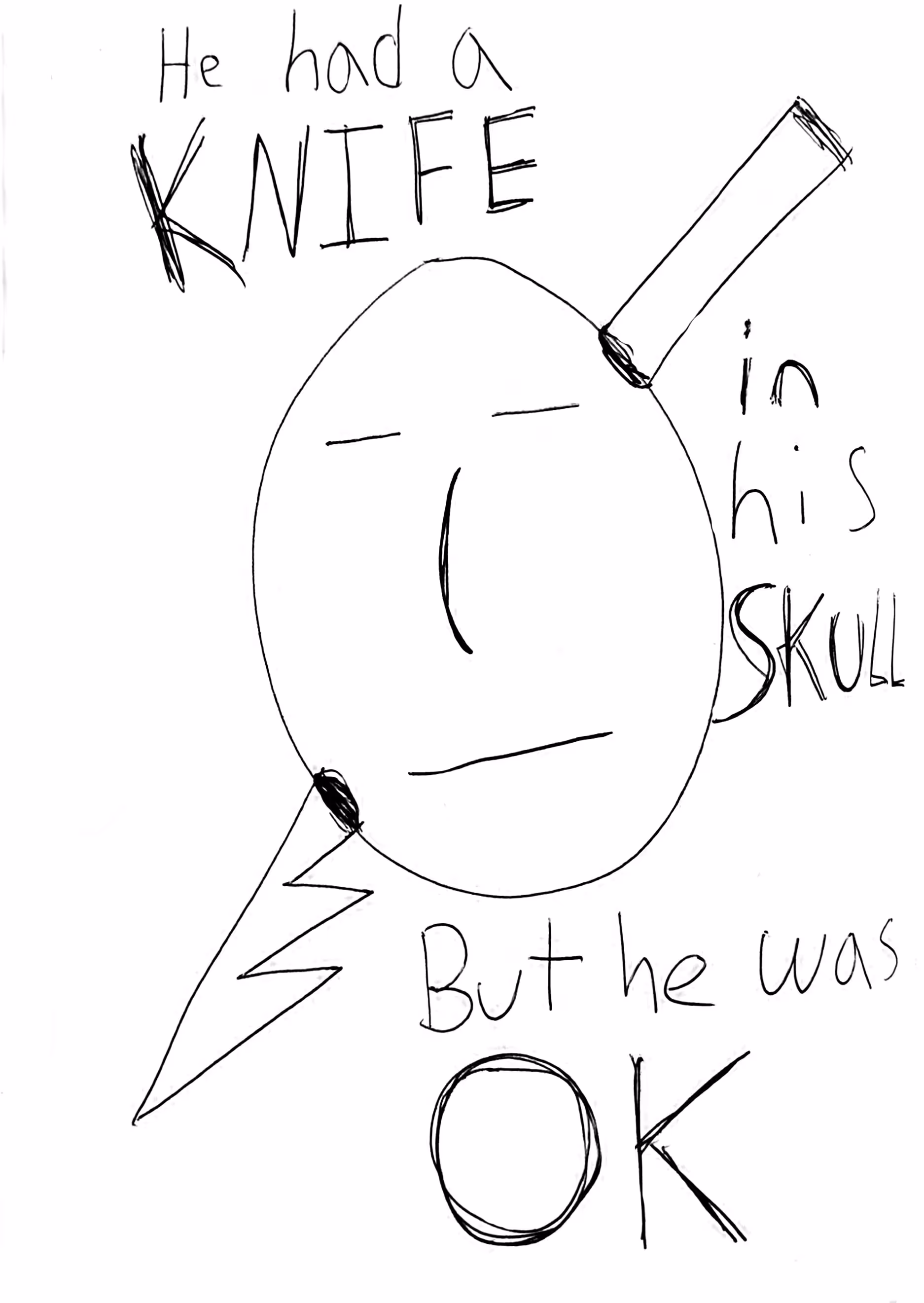 He Had A Knife In His Skull, But He Was OK