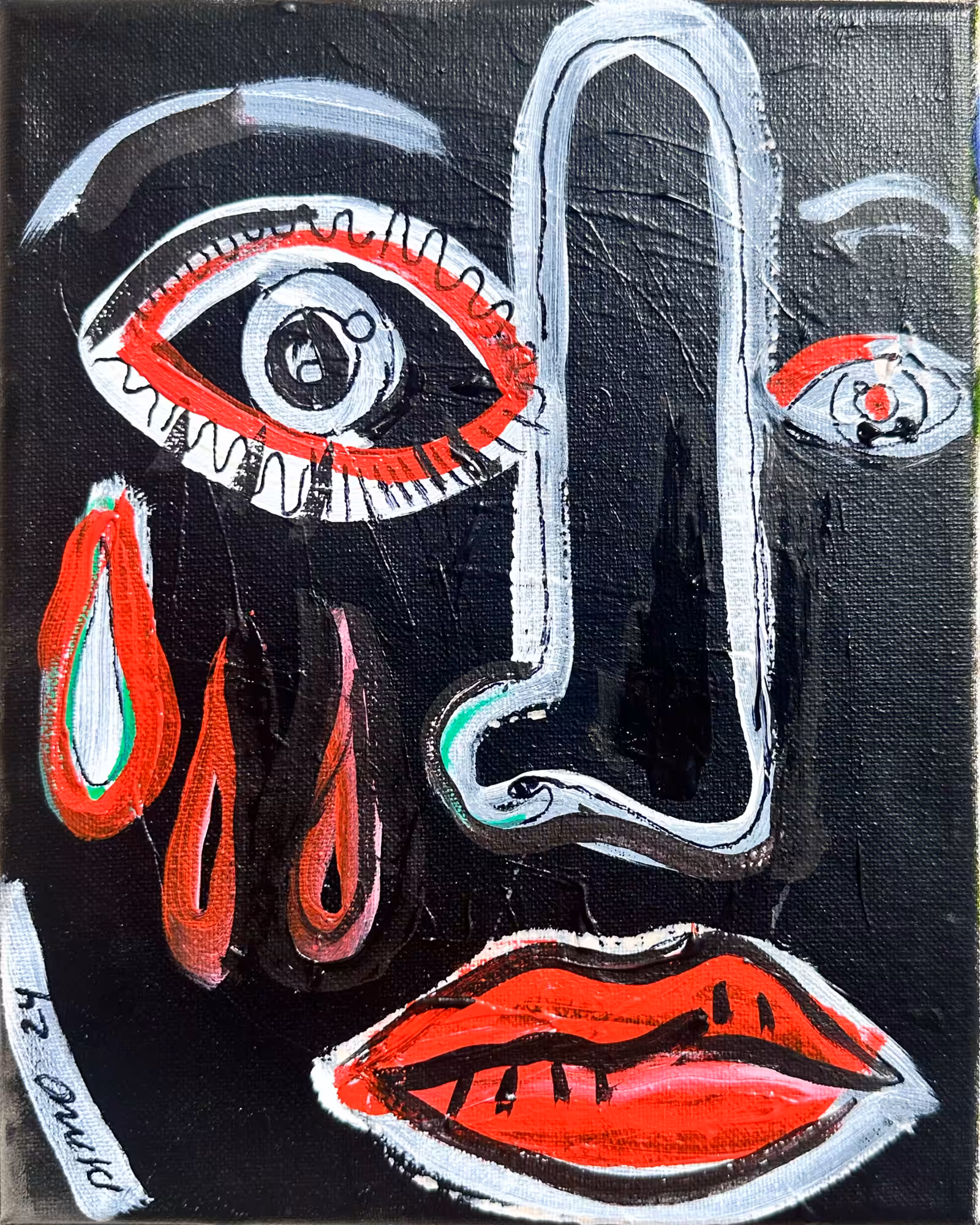 Pain