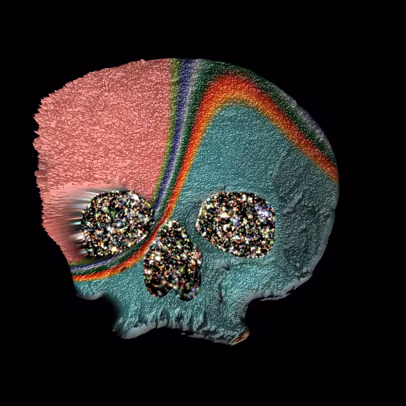 💀ACID SKULL🌈 #16