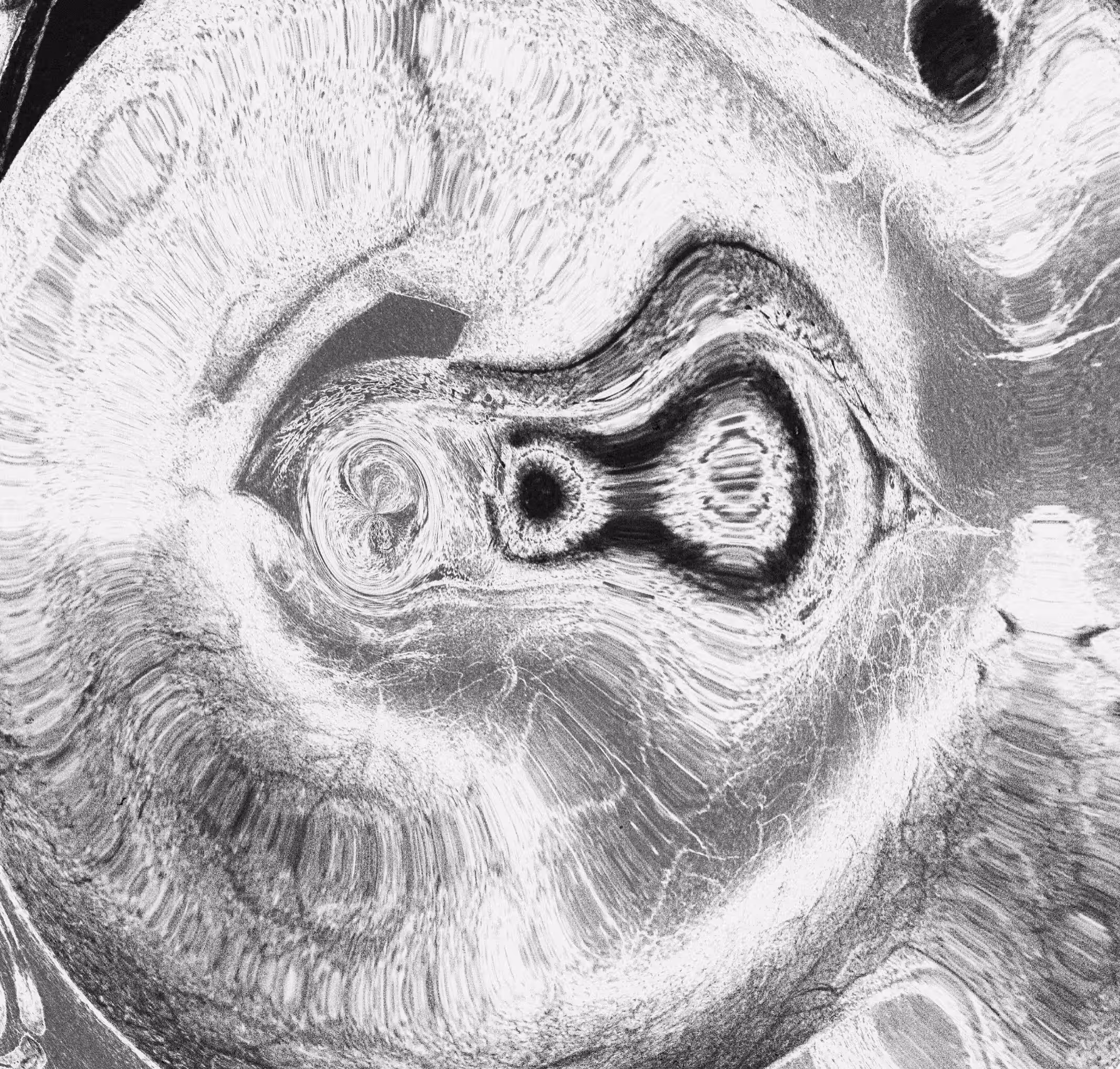 syzygy (Hypnogogic Vision)
