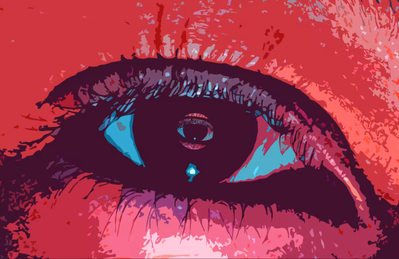 Cataract