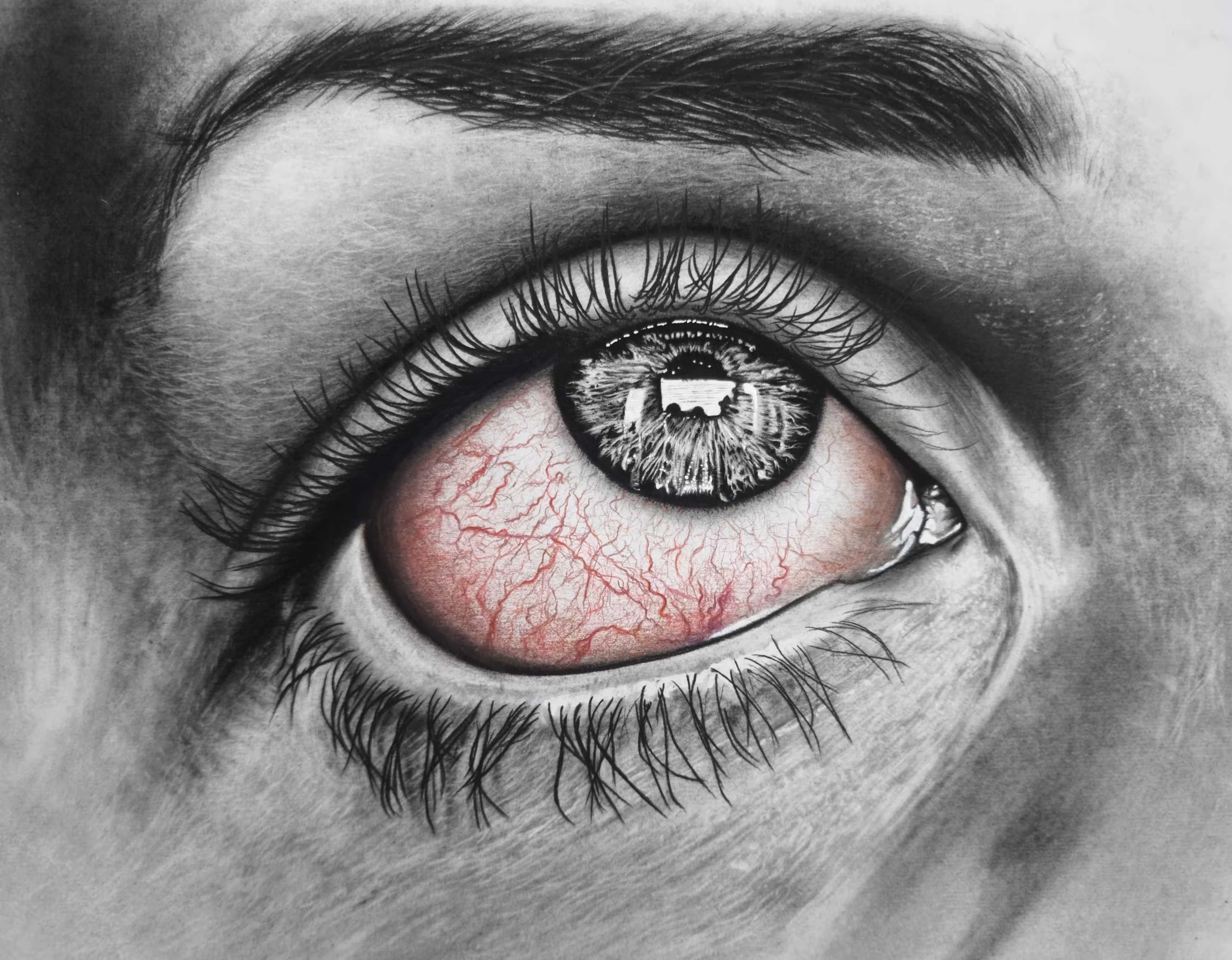 INSOMNIA