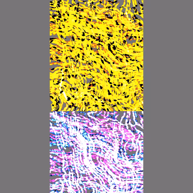 Nervography #3