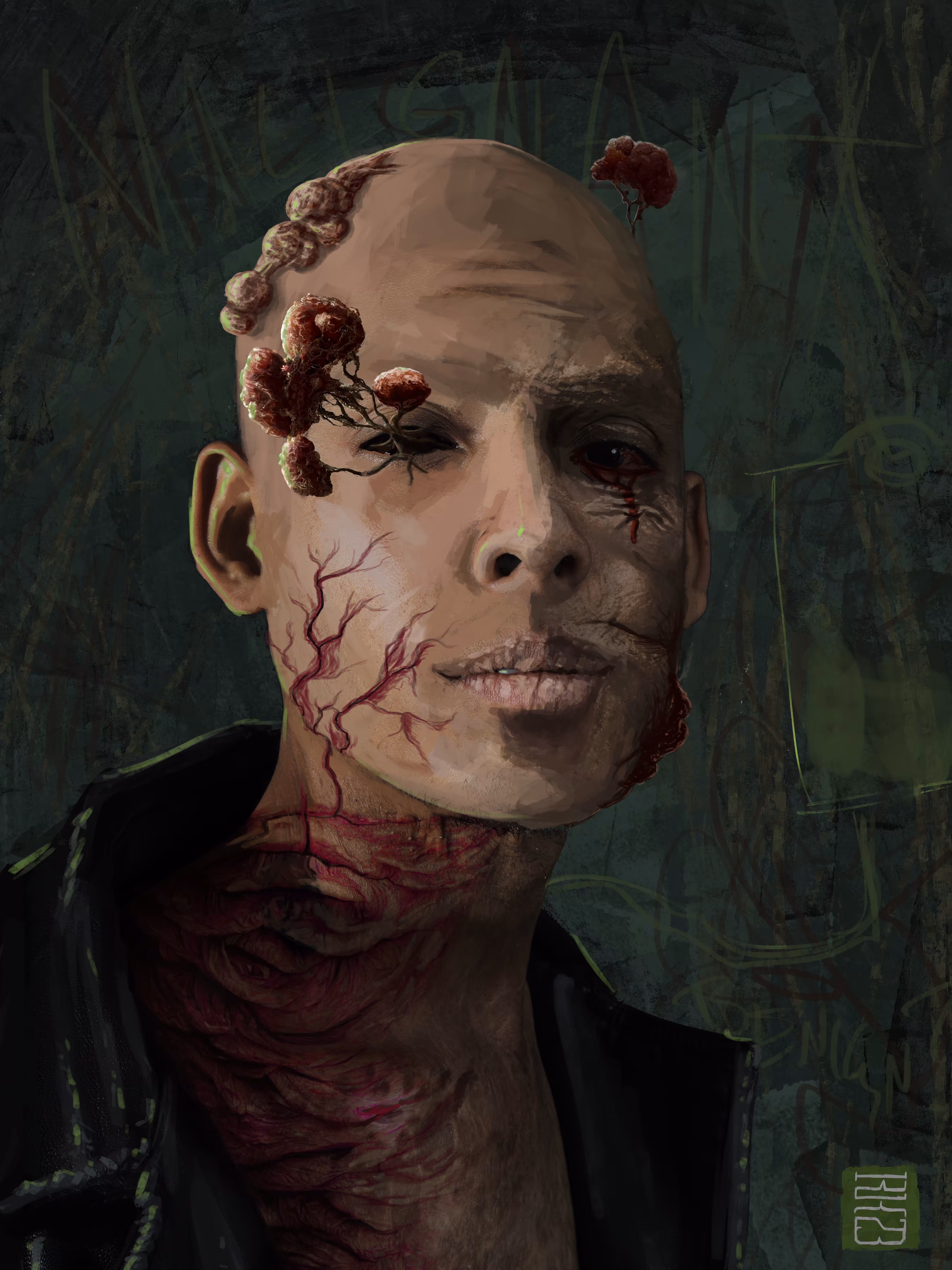 The Tsar of Tumors