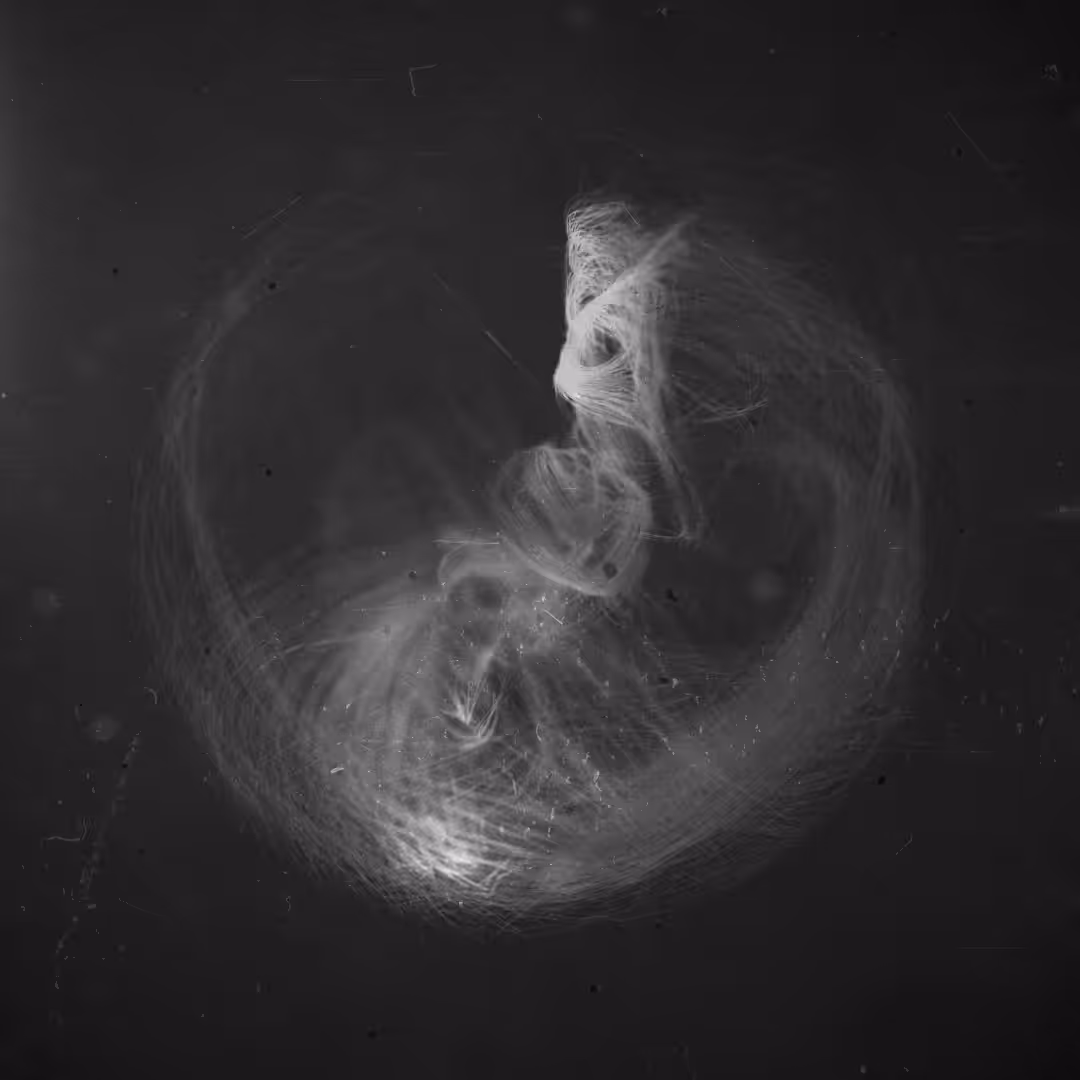 Captured Anomaly