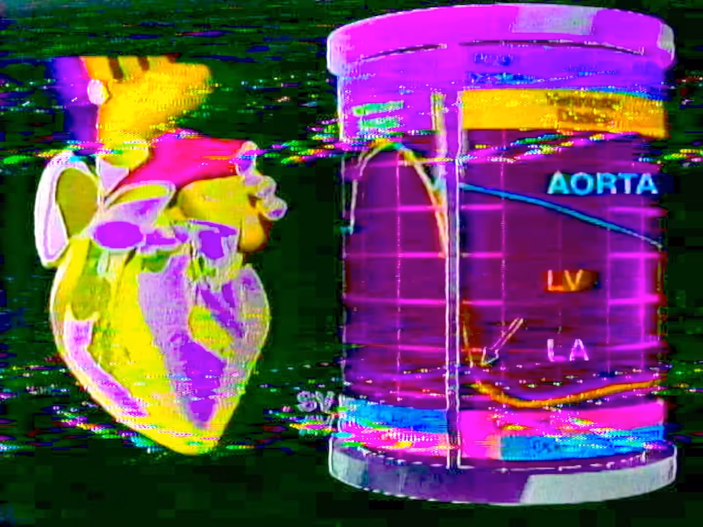 AORTA