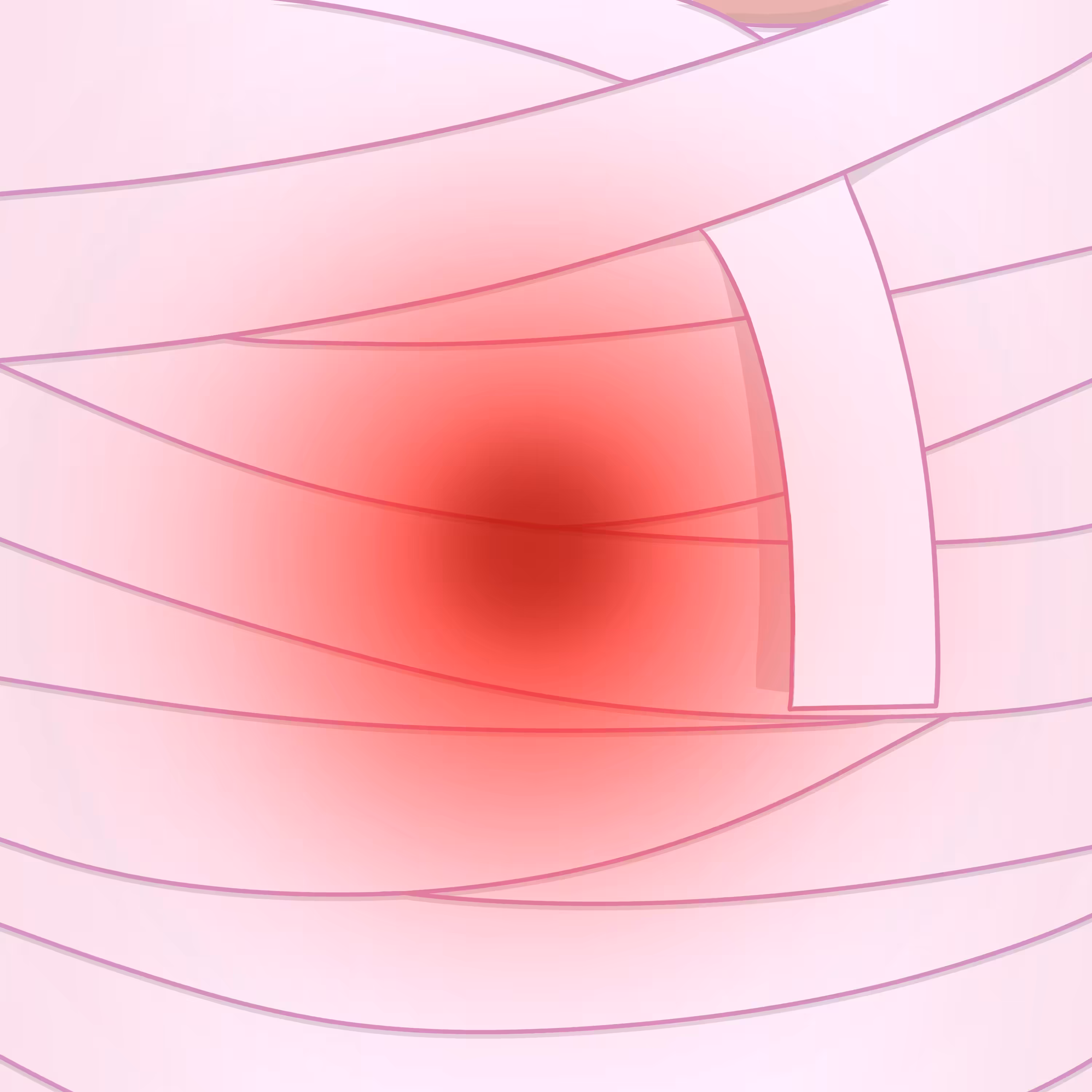 Wound
