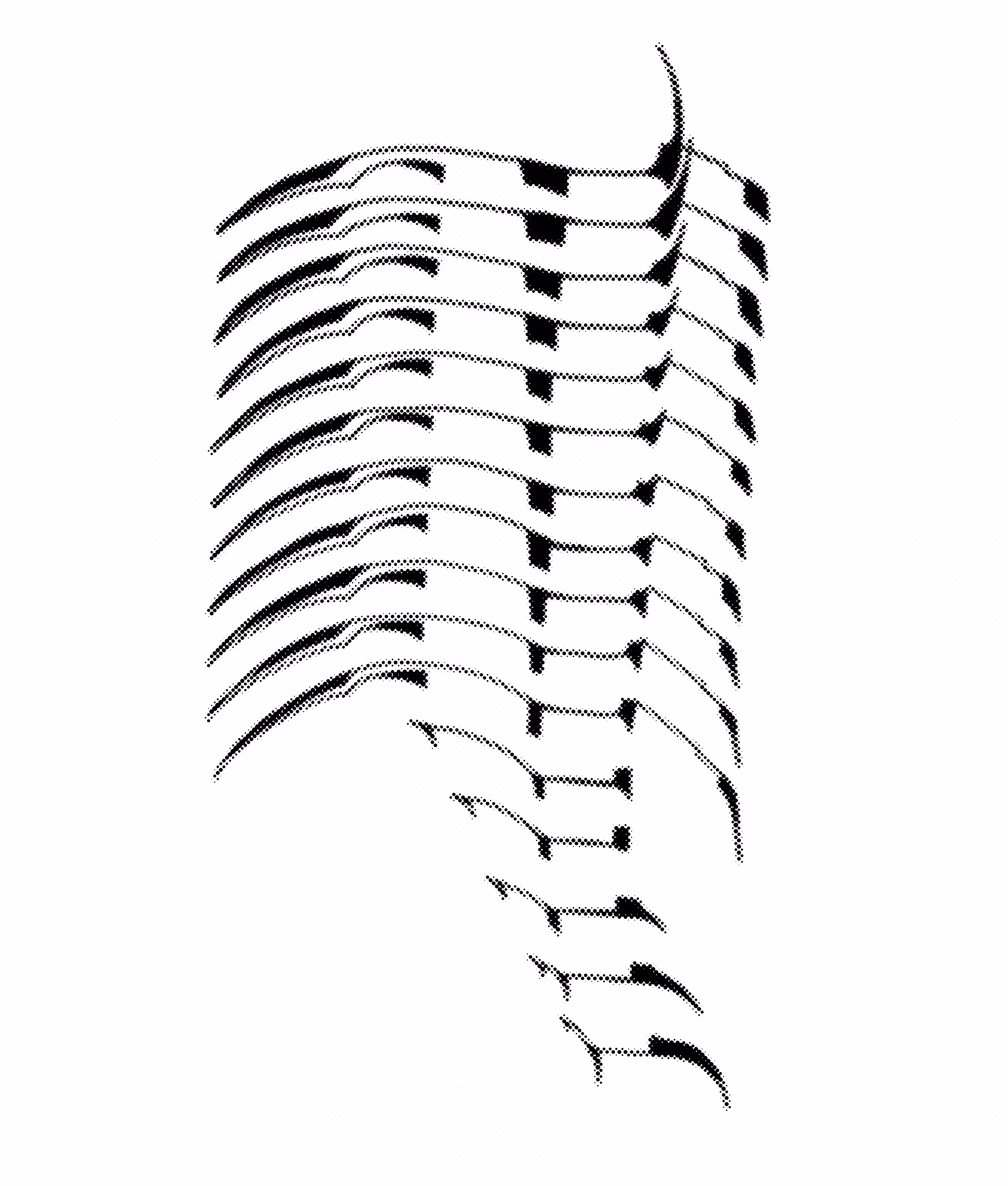 V
