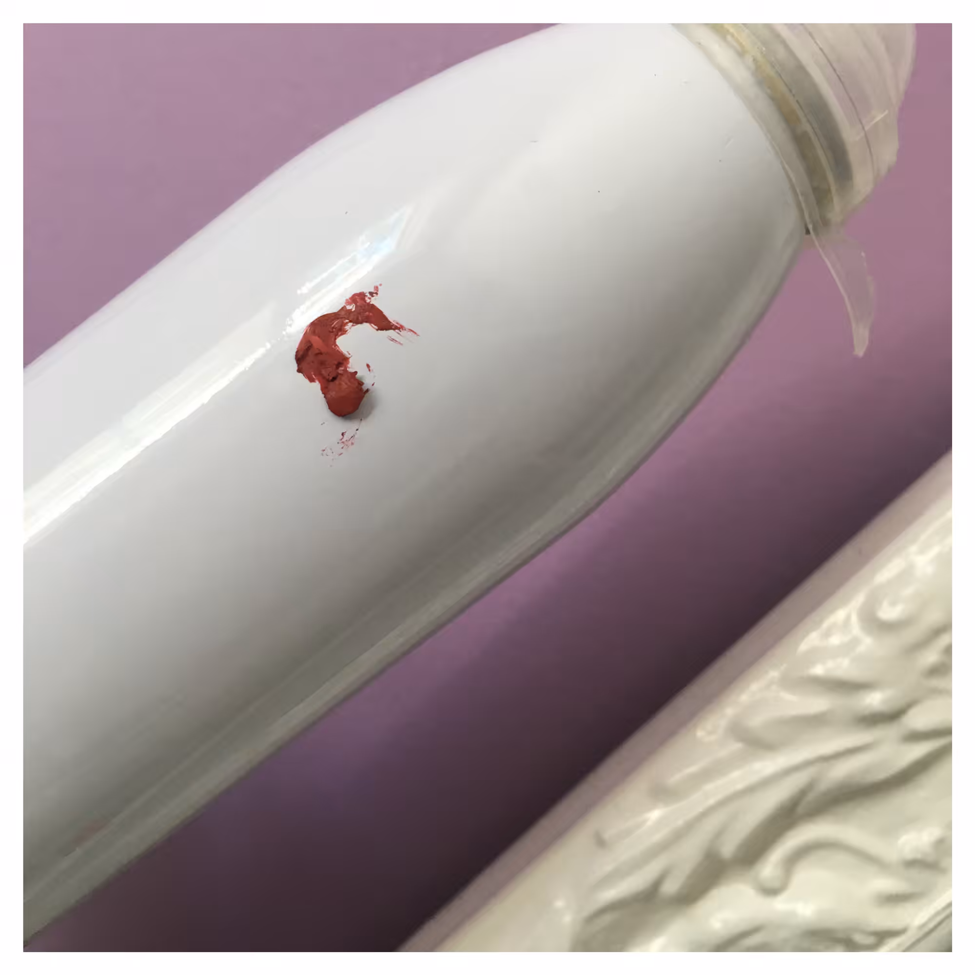 Wound