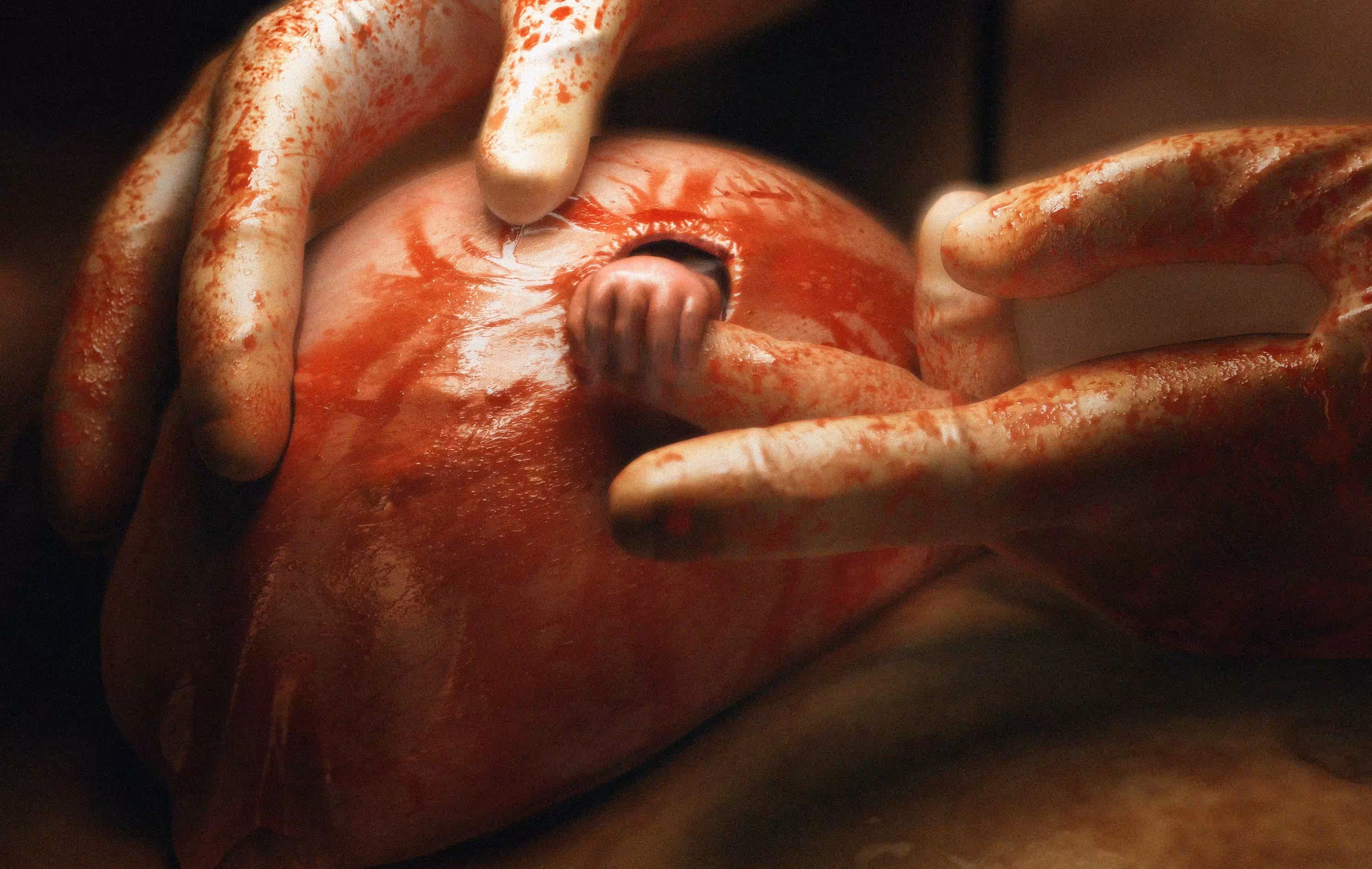 Hand of Hope 