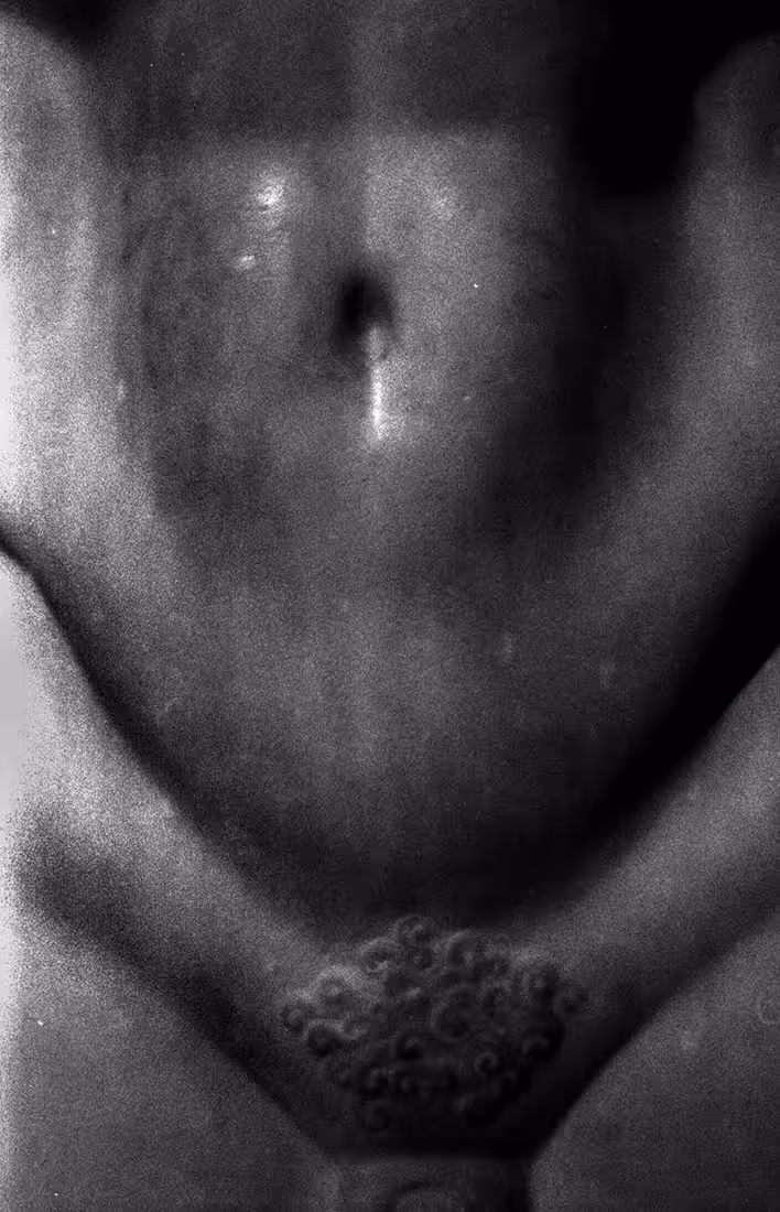 Stone skin