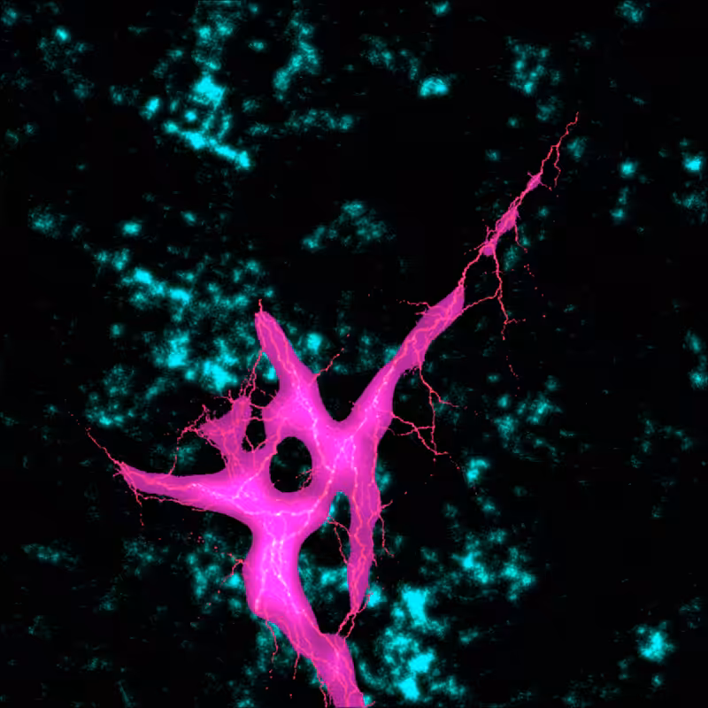 lightning in the brain #3