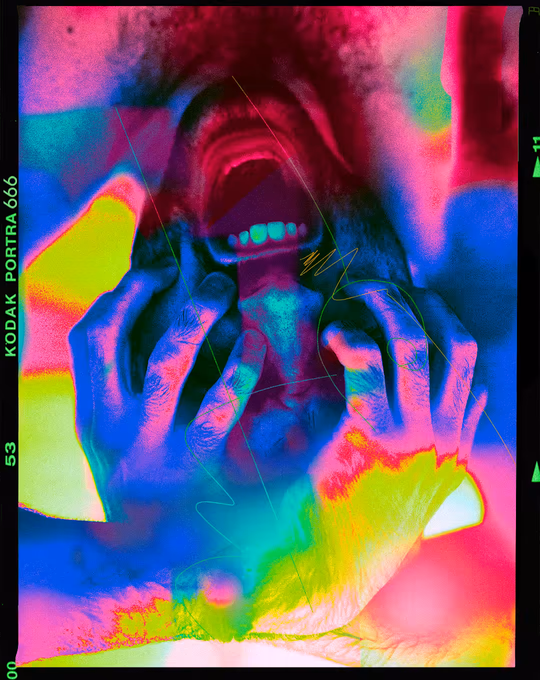 Agony