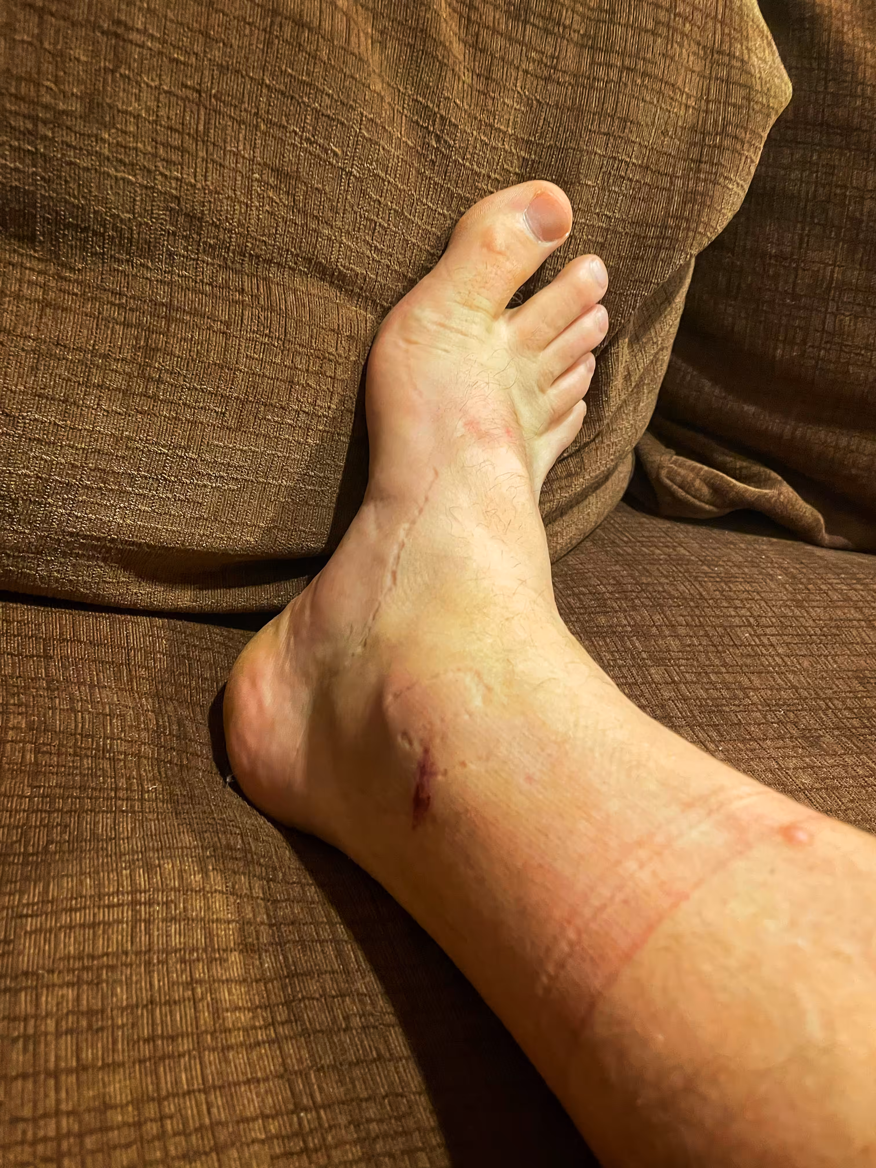 Cleated II