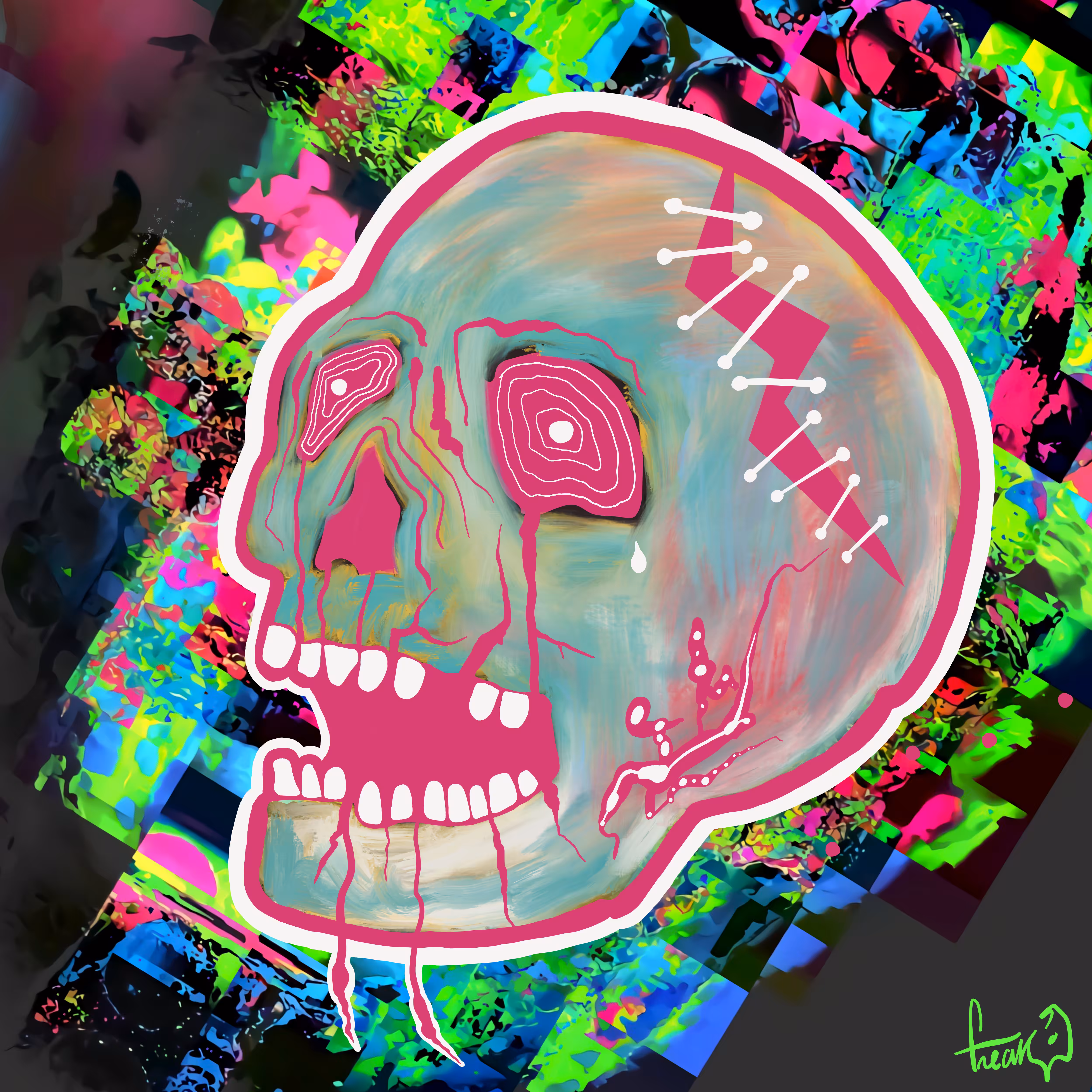 1# HEADACHE SKULL