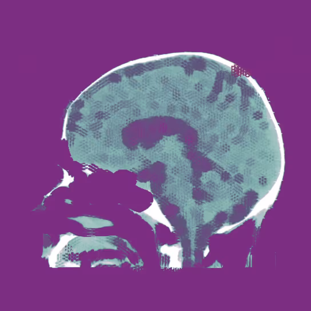 <_MyHead_n3_>