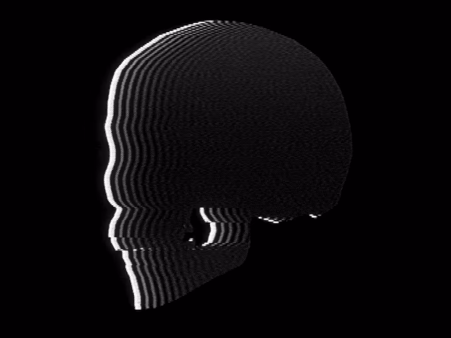 neurocranium loop