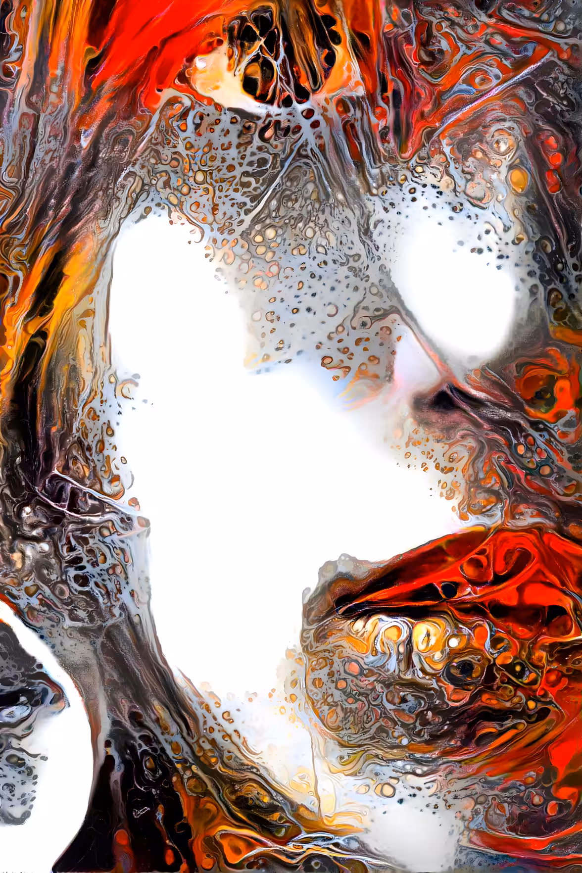 RART#1