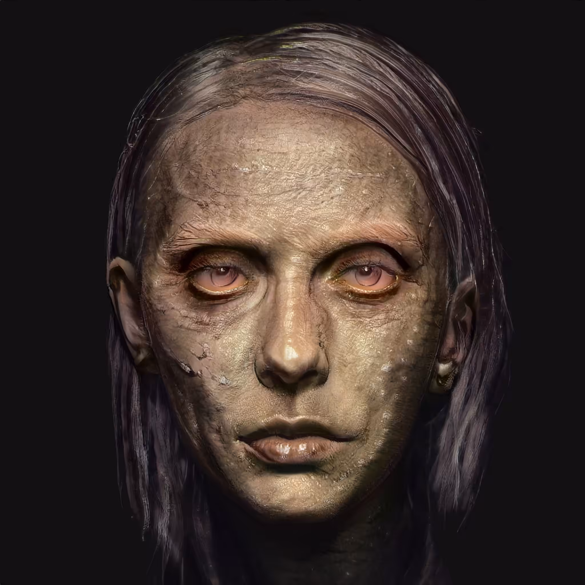 Patient 3