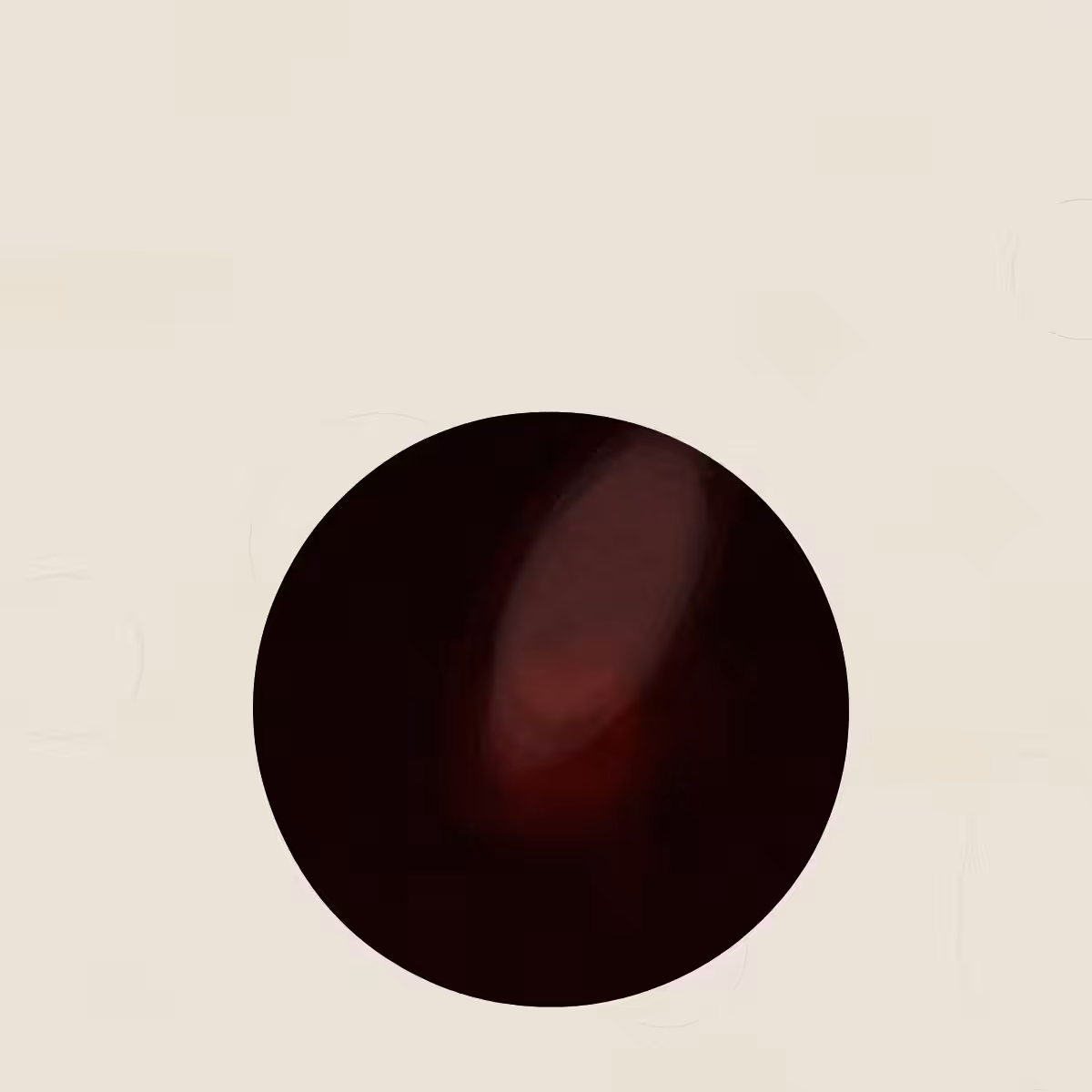 SYSTEMS #93